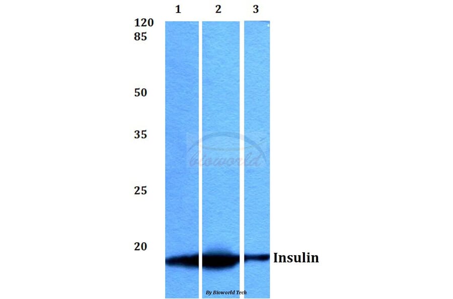 Anti-Insulin (F49) Antibody from Bioworld Technology (BS3546) - Antibodies.com