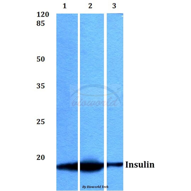 Anti-Insulin (F49) Antibody from Bioworld Technology (BS3546) - Antibodies.com