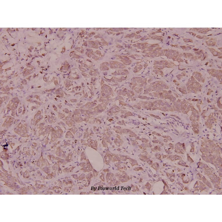 Anti-Insulin (F49) Antibody from Bioworld Technology (BS3546) - Antibodies.com