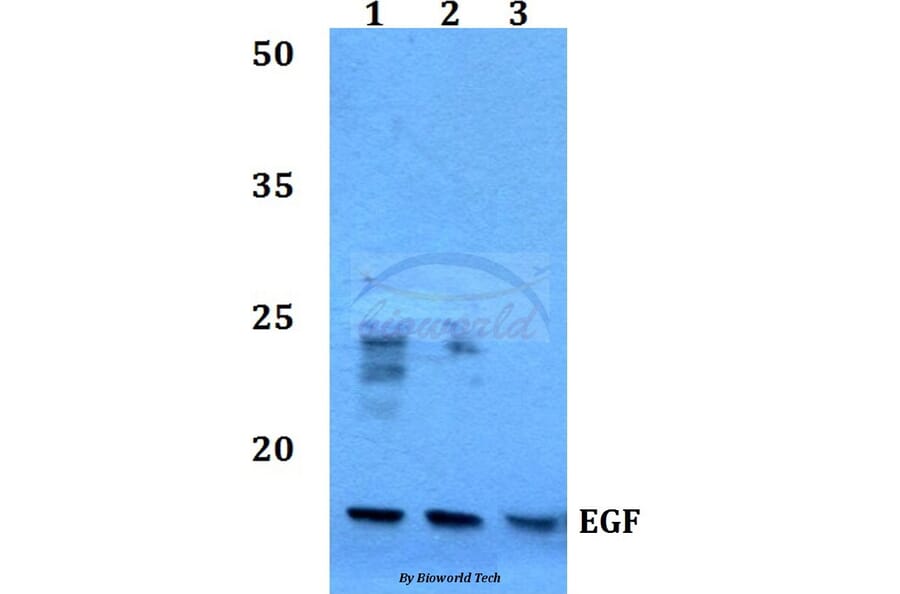 Anti-EGF (R709) Antibody from Bioworld Technology (BS3549) - Antibodies.com