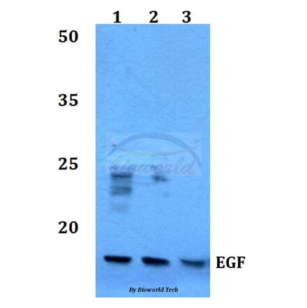 Anti-EGF (R709) Antibody from Bioworld Technology (BS3549) - Antibodies.com