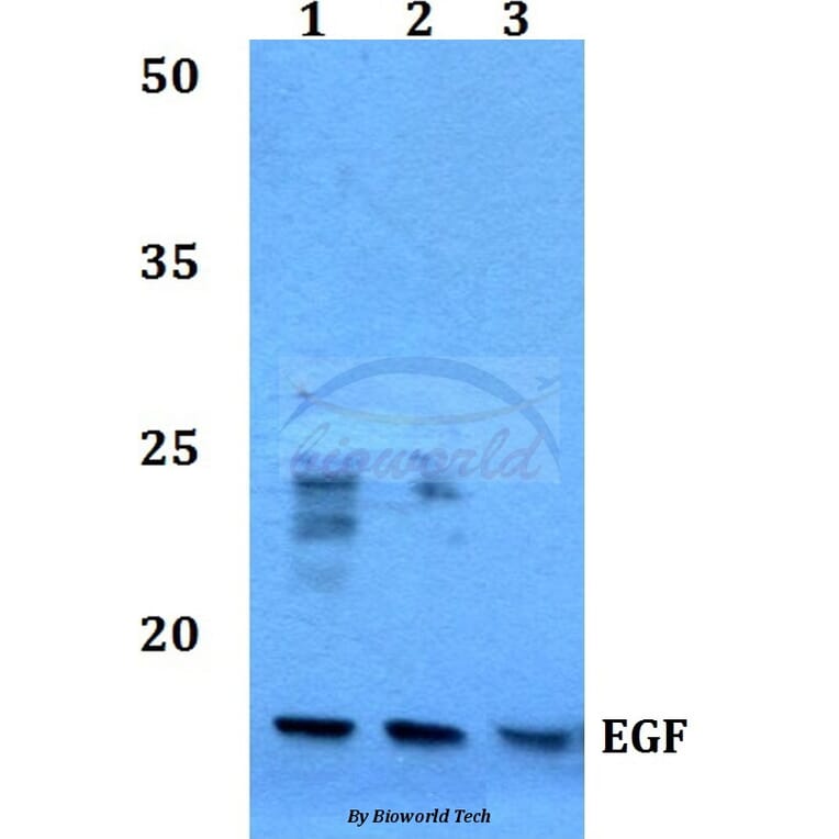 Anti-EGF (R709) Antibody from Bioworld Technology (BS3549) - Antibodies.com