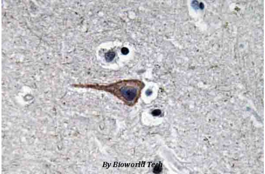 Anti-EGF (R709) Antibody from Bioworld Technology (BS3549) - Antibodies.com