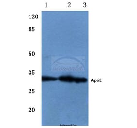 Anti-ApoE (M86) Antibody from Bioworld Technology (BS3550) - Antibodies.com