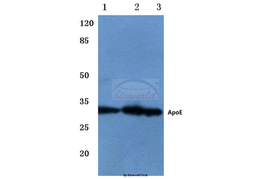 Anti-ApoE (M86) Antibody from Bioworld Technology (BS3550) - Antibodies.com