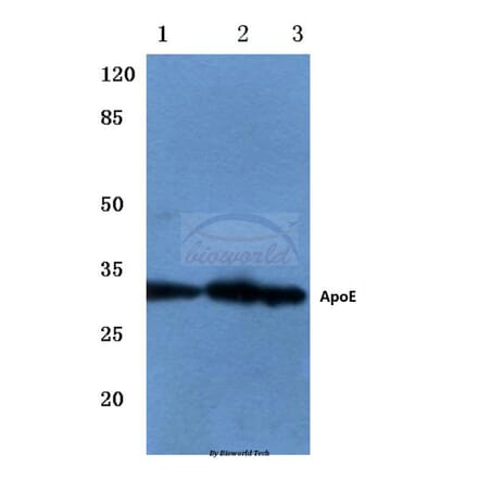 Anti-ApoE (M86) Antibody from Bioworld Technology (BS3550) - Antibodies.com
