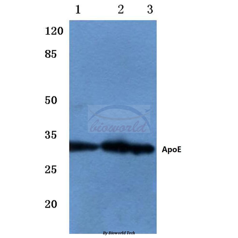 Anti-ApoE (M86) Antibody from Bioworld Technology (BS3550) - Antibodies.com