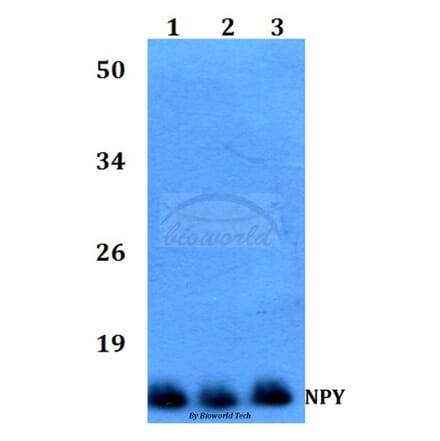 Anti-NPY (P94) Antibody from Bioworld Technology (BS3551) - Antibodies.com