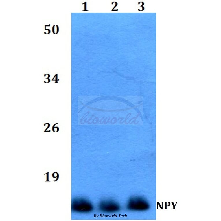 Anti-NPY (P94) Antibody from Bioworld Technology (BS3551) - Antibodies.com