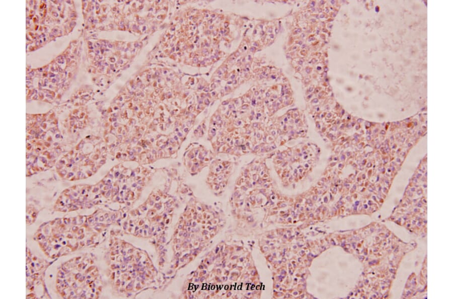 Anti-NPY (P94) Antibody from Bioworld Technology (BS3551) - Antibodies.com