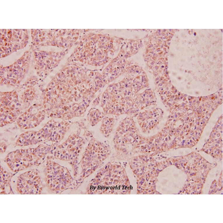 Anti-NPY (P94) Antibody from Bioworld Technology (BS3551) - Antibodies.com