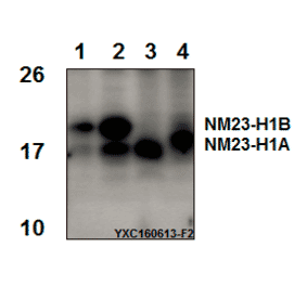 Anti-NM23-H1 (Y52) Antibody from Bioworld Technology (BS3552) - Antibodies.com