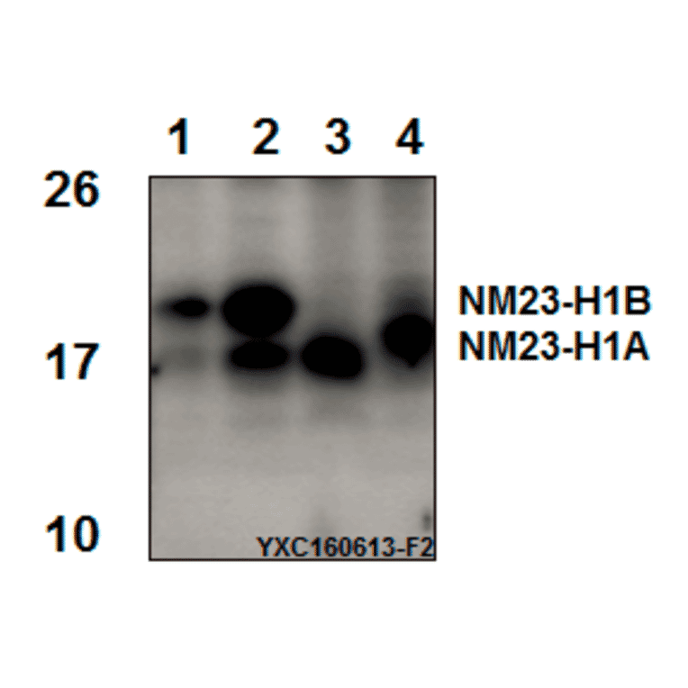 Anti-NM23-H1 (Y52) Antibody from Bioworld Technology (BS3552) - Antibodies.com