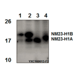 Anti-NM23-H1 (Y52) Antibody from Bioworld Technology (BS3552) - Antibodies.com