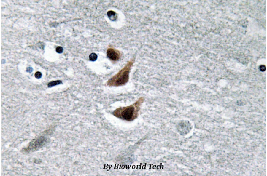 Anti-NM23-H1 (Y52) Antibody from Bioworld Technology (BS3552) - Antibodies.com