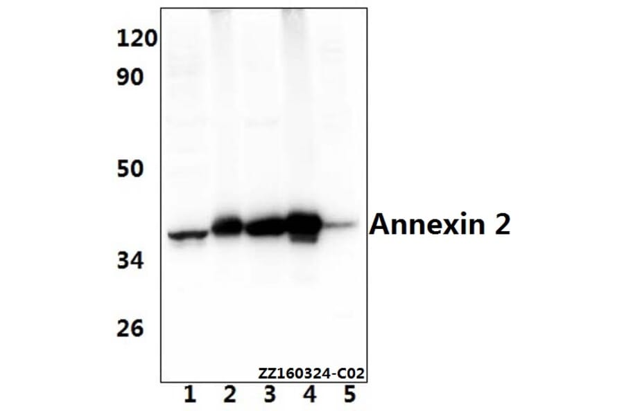 Anti-Annexin 2 (N137) Antibody from Bioworld Technology (BS3553) - Antibodies.com