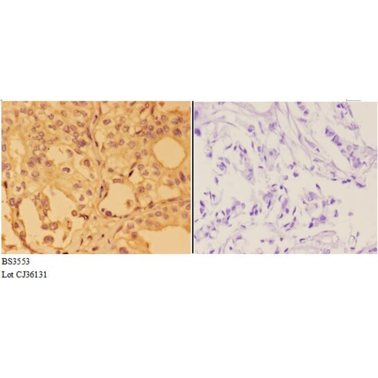 Anti-Annexin 2 (N137) Antibody from Bioworld Technology (BS3553) - Antibodies.com