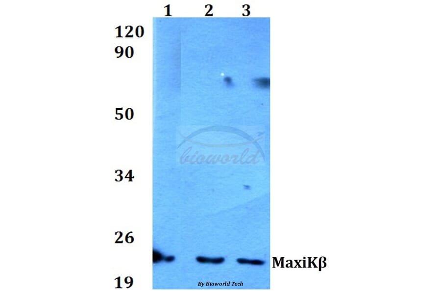 Anti-MaxiKβ (K119) Antibody from Bioworld Technology (BS3554) - Antibodies.com