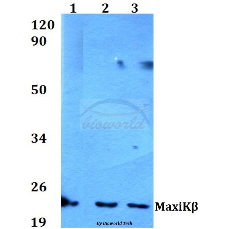 Anti-MaxiKβ (K119) Antibody from Bioworld Technology (BS3554) - Antibodies.com