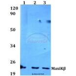 Anti-MaxiKβ (K119) Antibody from Bioworld Technology (BS3554) - Antibodies.com