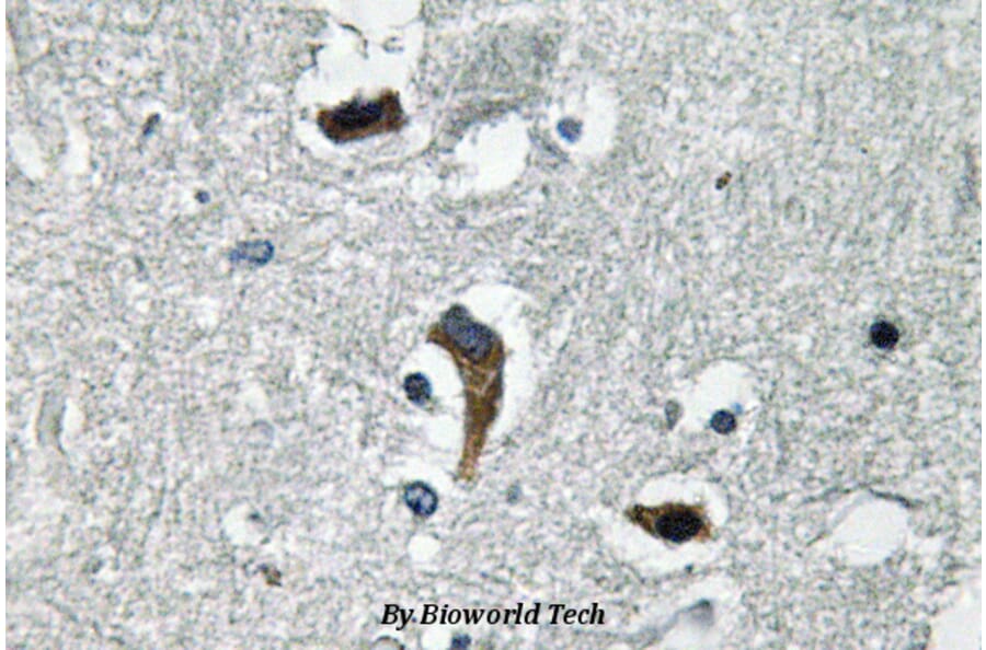 Anti-MaxiKβ (K119) Antibody from Bioworld Technology (BS3554) - Antibodies.com