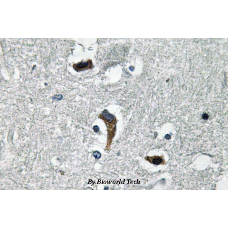 Anti-MaxiKβ (K119) Antibody from Bioworld Technology (BS3554) - Antibodies.com
