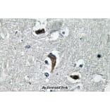 Anti-MaxiKβ (K119) Antibody from Bioworld Technology (BS3554) - Antibodies.com