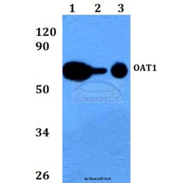 Anti-OAT1 (L304) Antibody from Bioworld Technology (BS3556) - Antibodies.com