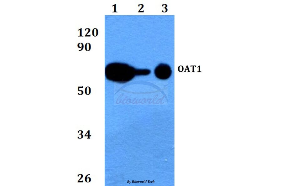 Anti-OAT1 (L304) Antibody from Bioworld Technology (BS3556) - Antibodies.com