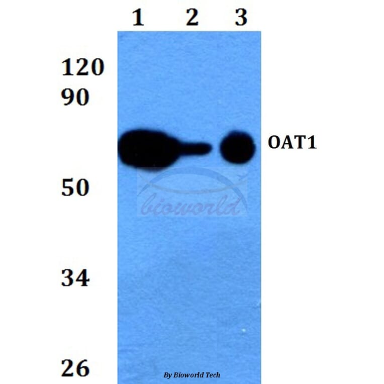 Anti-OAT1 (L304) Antibody from Bioworld Technology (BS3556) - Antibodies.com