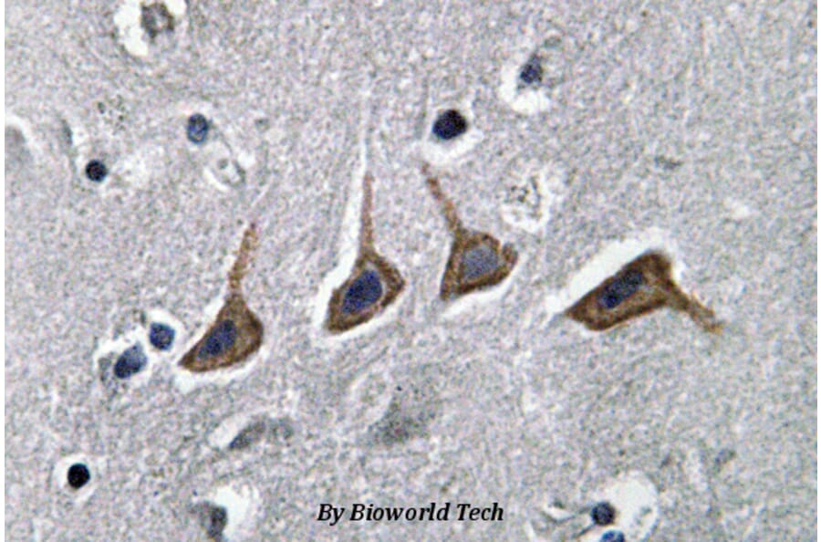 Anti-OAT1 (L304) Antibody from Bioworld Technology (BS3556) - Antibodies.com