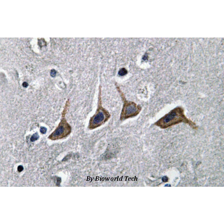 Anti-OAT1 (L304) Antibody from Bioworld Technology (BS3556) - Antibodies.com