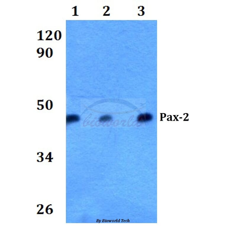 Anti-Pax-2 (I193) Antibody from Bioworld Technology (BS3557) - Antibodies.com