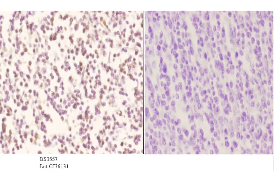 Anti-Pax-2 (I193) Antibody from Bioworld Technology (BS3557) - Antibodies.com