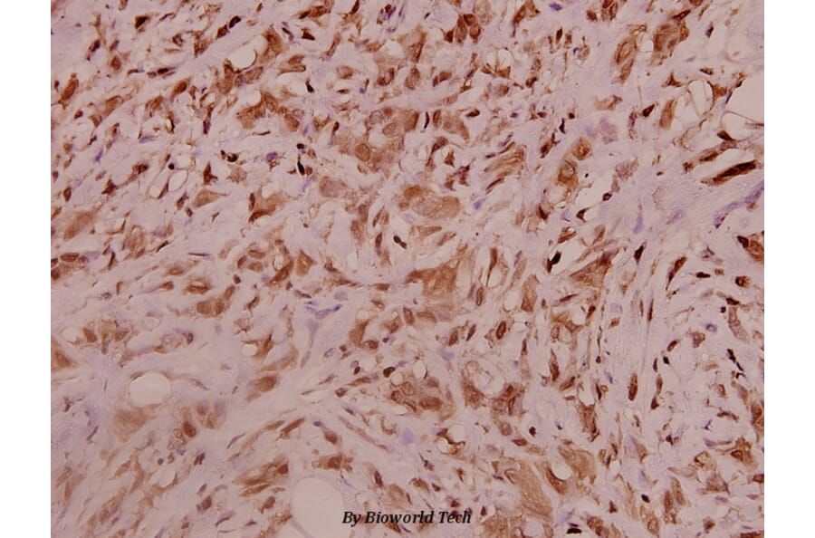 Anti-Na+ CP type α-pan (E1476) Antibody from Bioworld Technology (BS3558) - Antibodies.com
