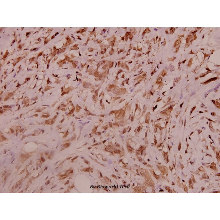Anti-Na+ CP type α-pan (E1476) Antibody from Bioworld Technology (BS3558) - Antibodies.com