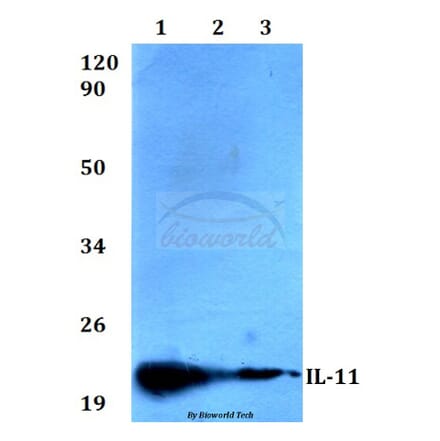 Anti-IL-11 (G27) Antibody from Bioworld Technology (BS3559) - Antibodies.com