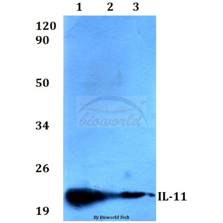 Anti-IL-11 (G27) Antibody from Bioworld Technology (BS3559) - Antibodies.com