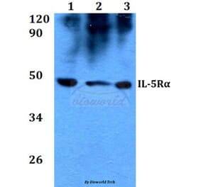 Anti-IL-5Rα (K68) Antibody from Bioworld Technology (BS3560) - Antibodies.com