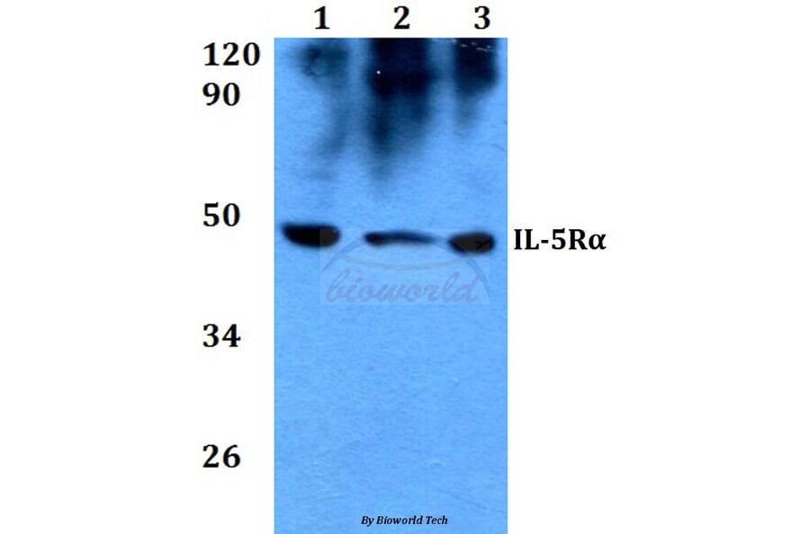 Anti-IL-5Rα (K68) Antibody from Bioworld Technology (BS3560) - Antibodies.com