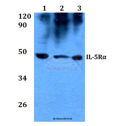 Anti-IL-5Rα (K68) Antibody from Bioworld Technology (BS3560) - Antibodies.com
