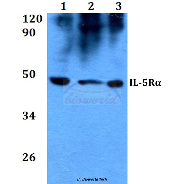 Anti-IL-5Rα (K68) Antibody from Bioworld Technology (BS3560) - Antibodies.com