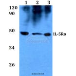 Anti-IL-5Rα (K68) Antibody from Bioworld Technology (BS3560) - Antibodies.com
