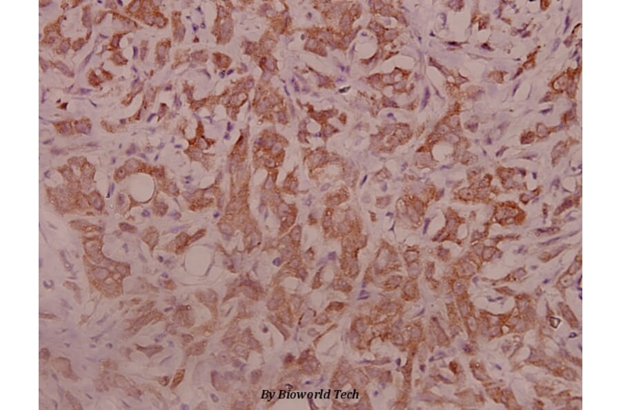 Anti-IL-5Rα (K68) Antibody from Bioworld Technology (BS3560) - Antibodies.com