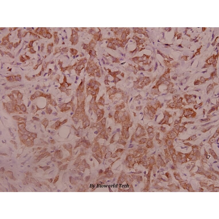 Anti-IL-5Rα (K68) Antibody from Bioworld Technology (BS3560) - Antibodies.com