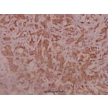 Anti-IL-5Rα (K68) Antibody from Bioworld Technology (BS3560) - Antibodies.com
