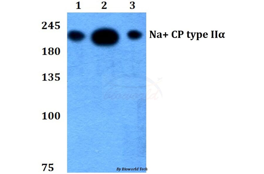 Anti-Na+ CP type IIα (K1032) Antibody from Bioworld Technology (BS3562) - Antibodies.com