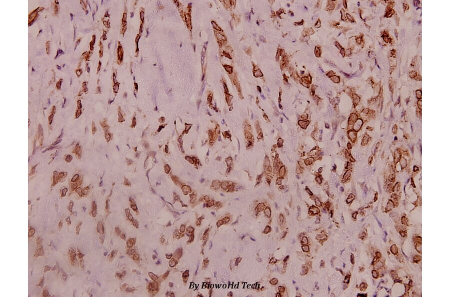 Anti-Na+ CP type IIα (K1032) Antibody from Bioworld Technology (BS3562) - Antibodies.com