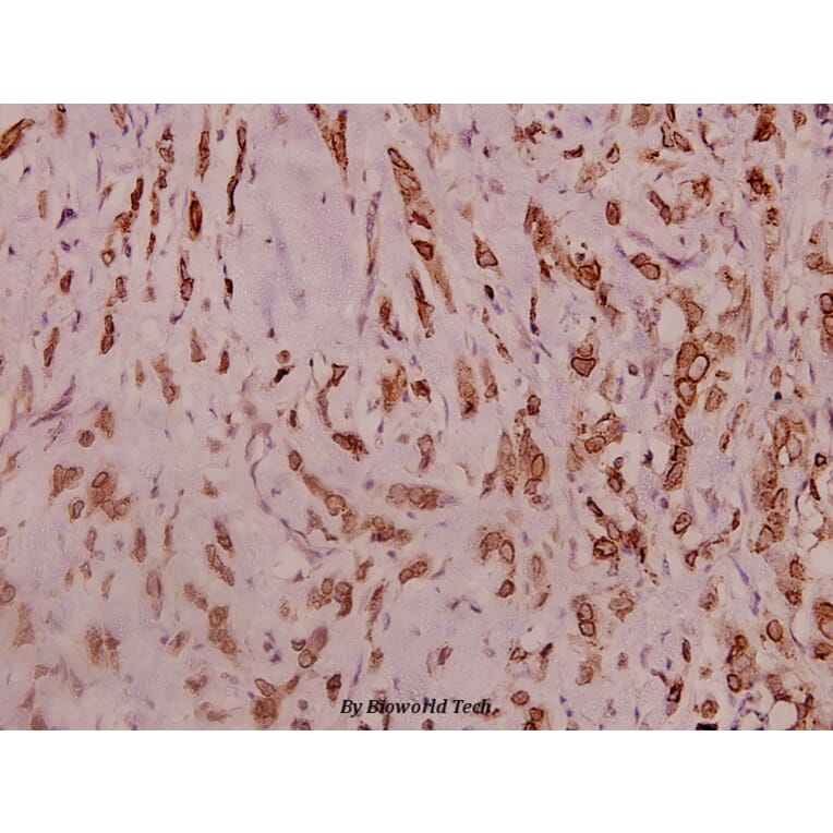 Anti-Na+ CP type IIα (K1032) Antibody from Bioworld Technology (BS3562) - Antibodies.com