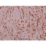 Anti-Na+ CP type IIα (K1032) Antibody from Bioworld Technology (BS3562) - Antibodies.com